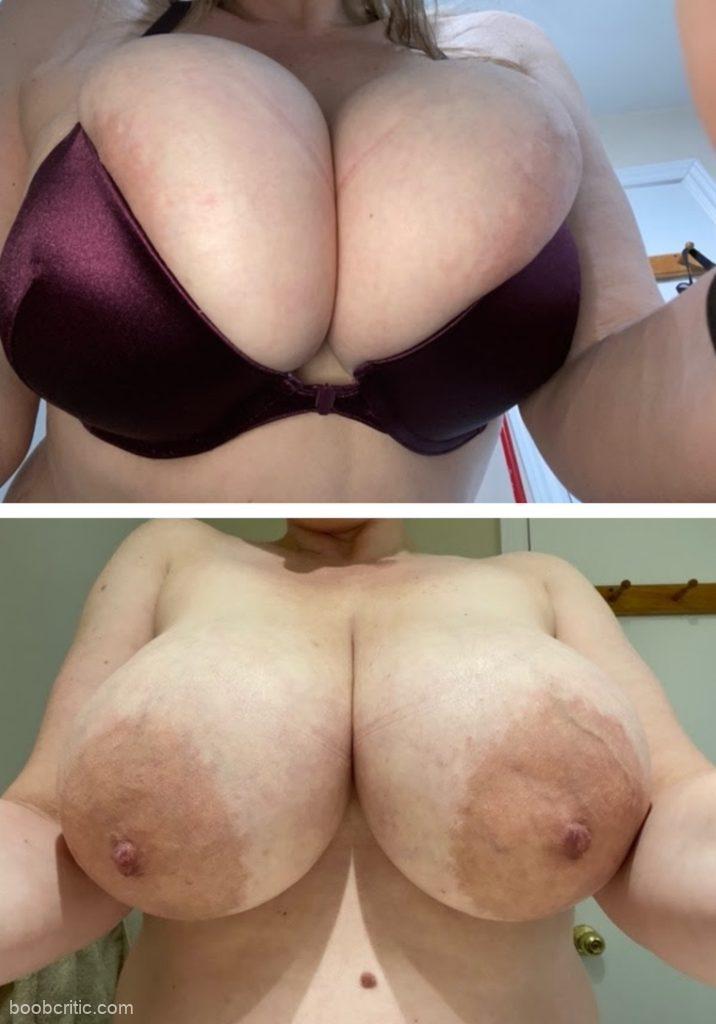 Wife Tits Bra Before and After