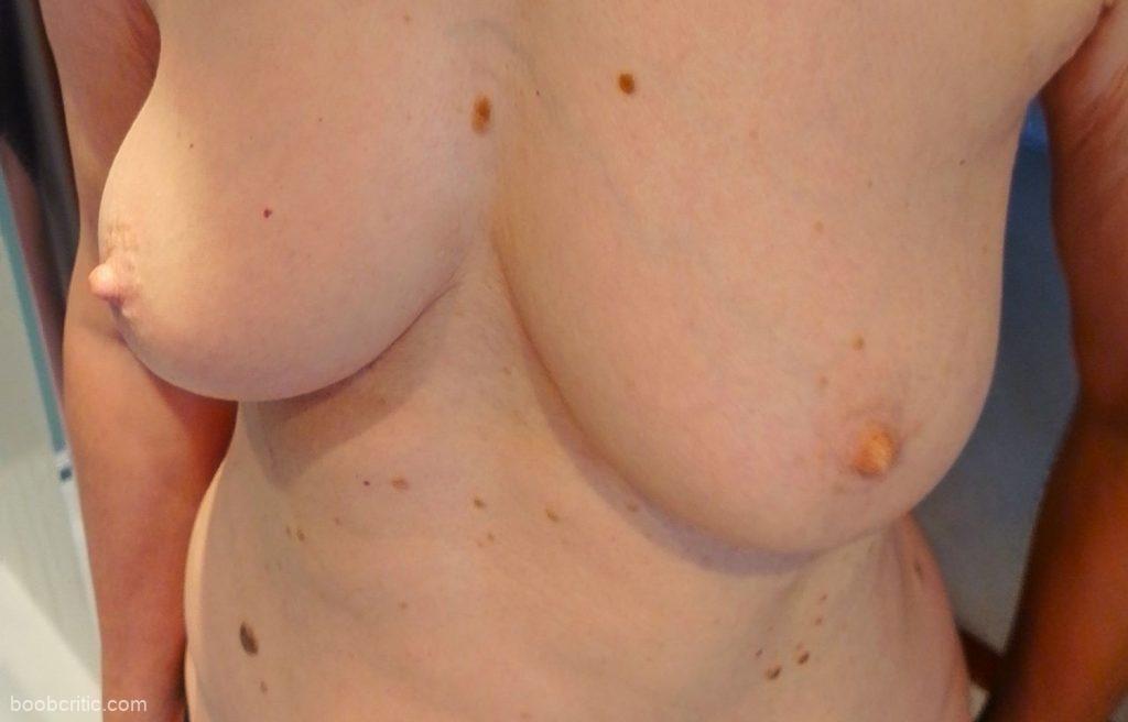 Sarah’s senior (70) medium breasts and erect nipples