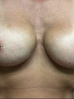 Nikki’s hard nipples