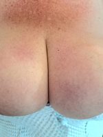 Red, tits ready for some TLC