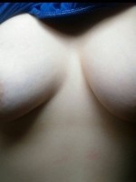 My uneven boobies ;)