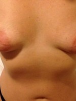 My Tits....big areolas