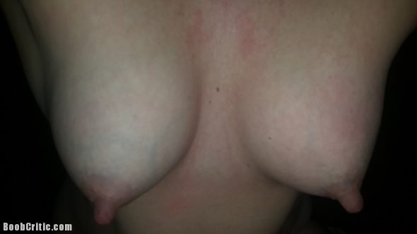 Swollen Nips Hanging